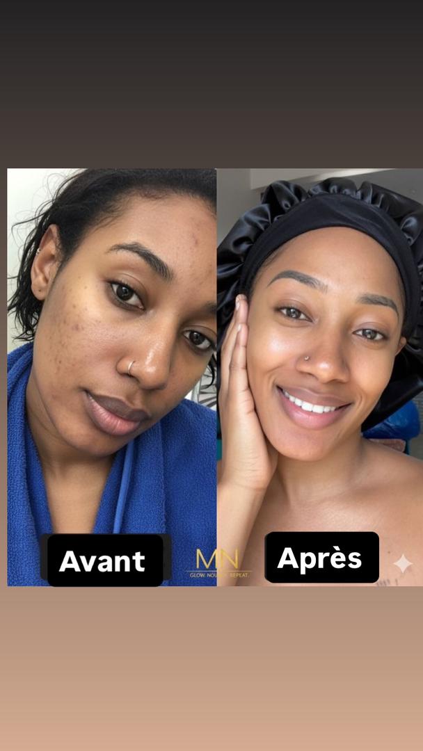 Brighten Serum + appareil de massage